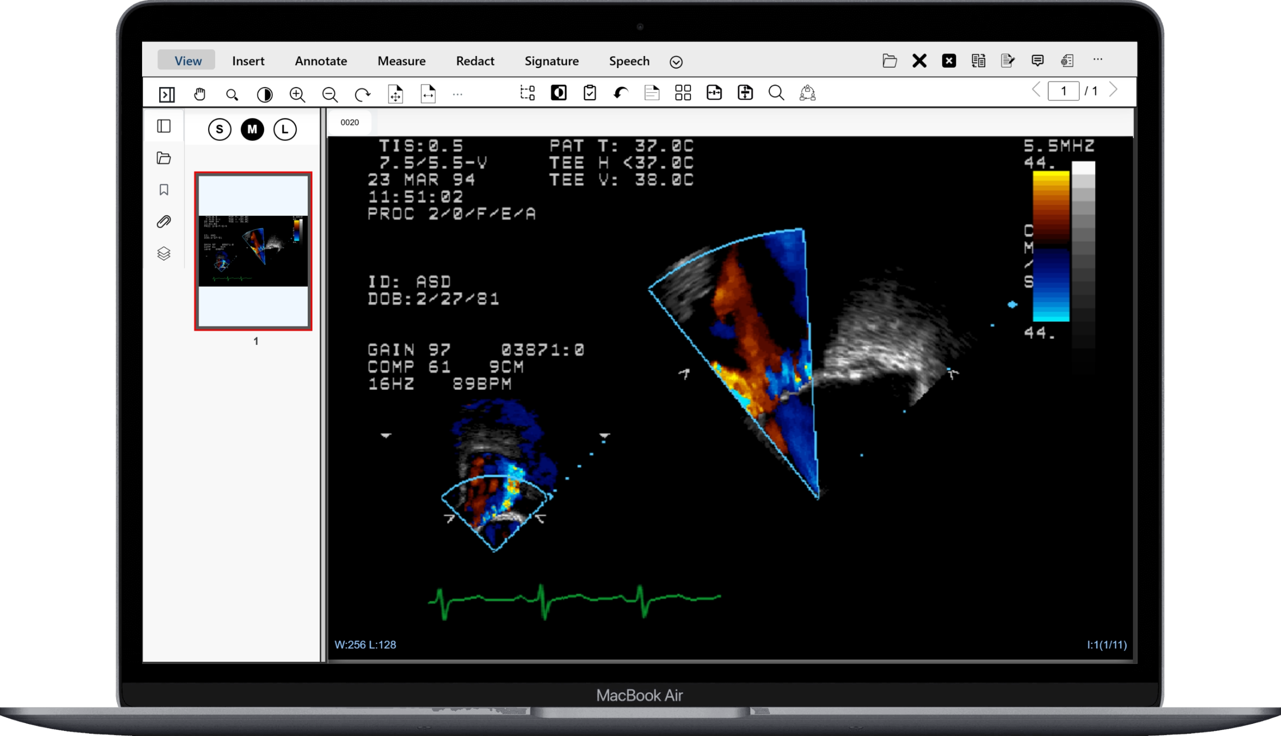 dicom support