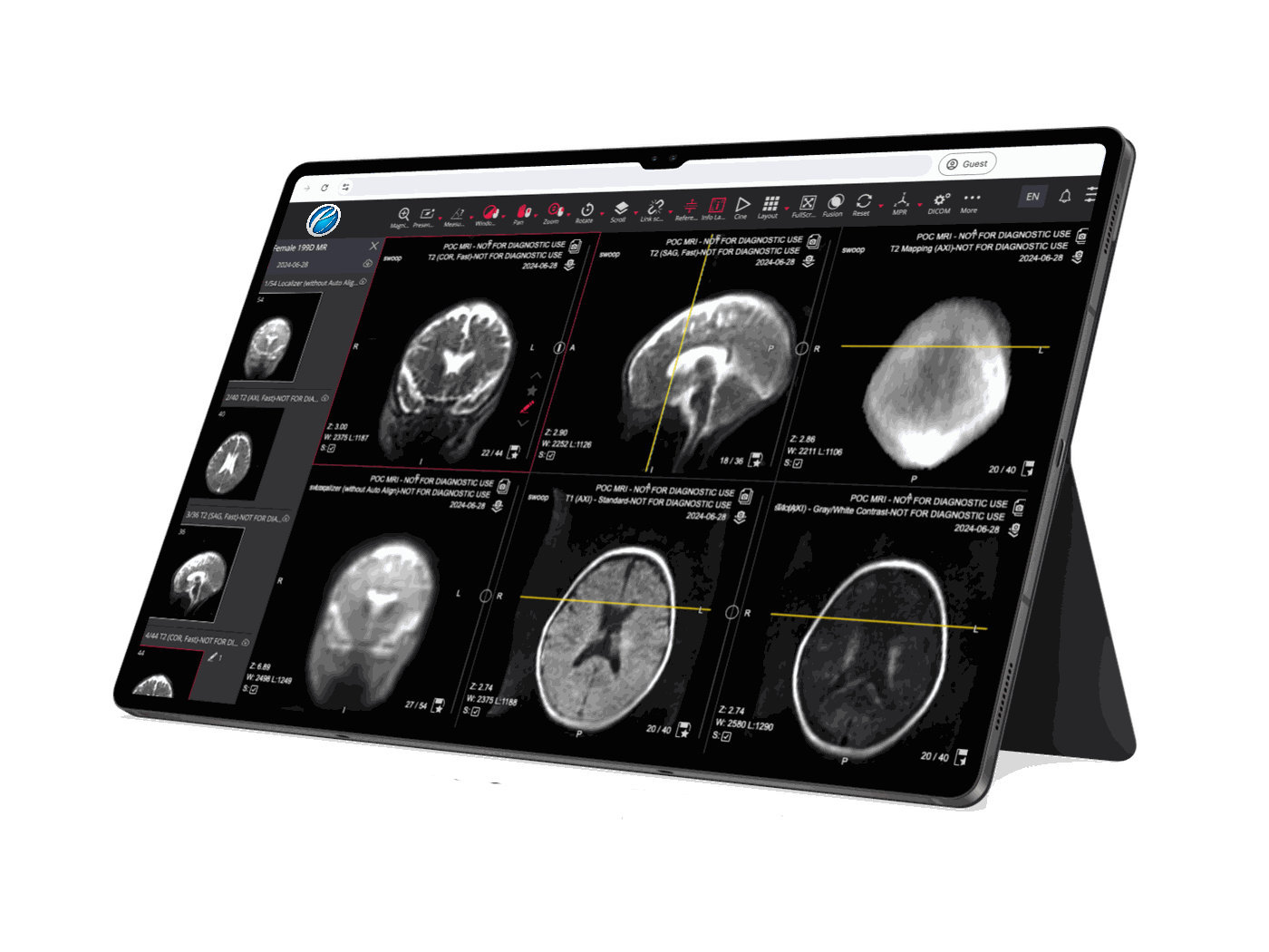 eviewer DICOM viewer on tablet
