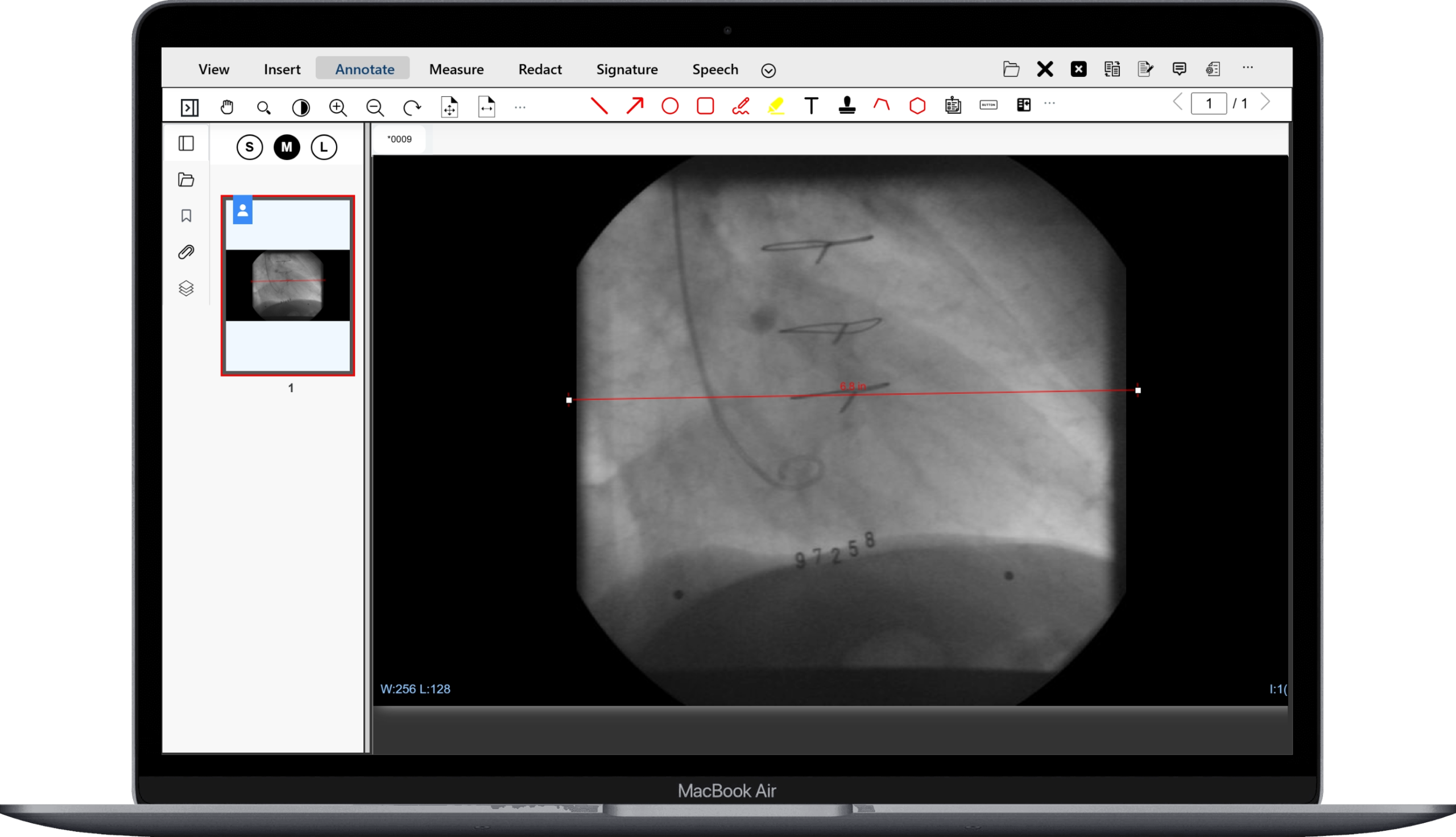 measurement on DICOM
